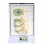 腰骶椎椎間盤和脊神經(jīng)電動模型 