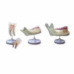 磨牙、乳牙、恒牙模型