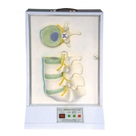 腰骶椎椎間盤和脊神經(jīng)電動模型 