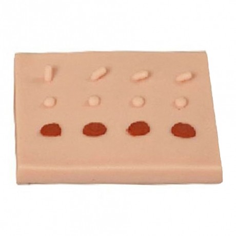 表皮常見病變處理訓練模塊