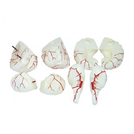 腦及腦動脈模型