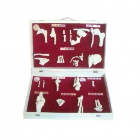 人體骨關(guān)節(jié)分類模型