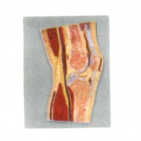 髖關節(jié)剖面模型