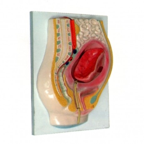 胎盤(pán)剝離模型