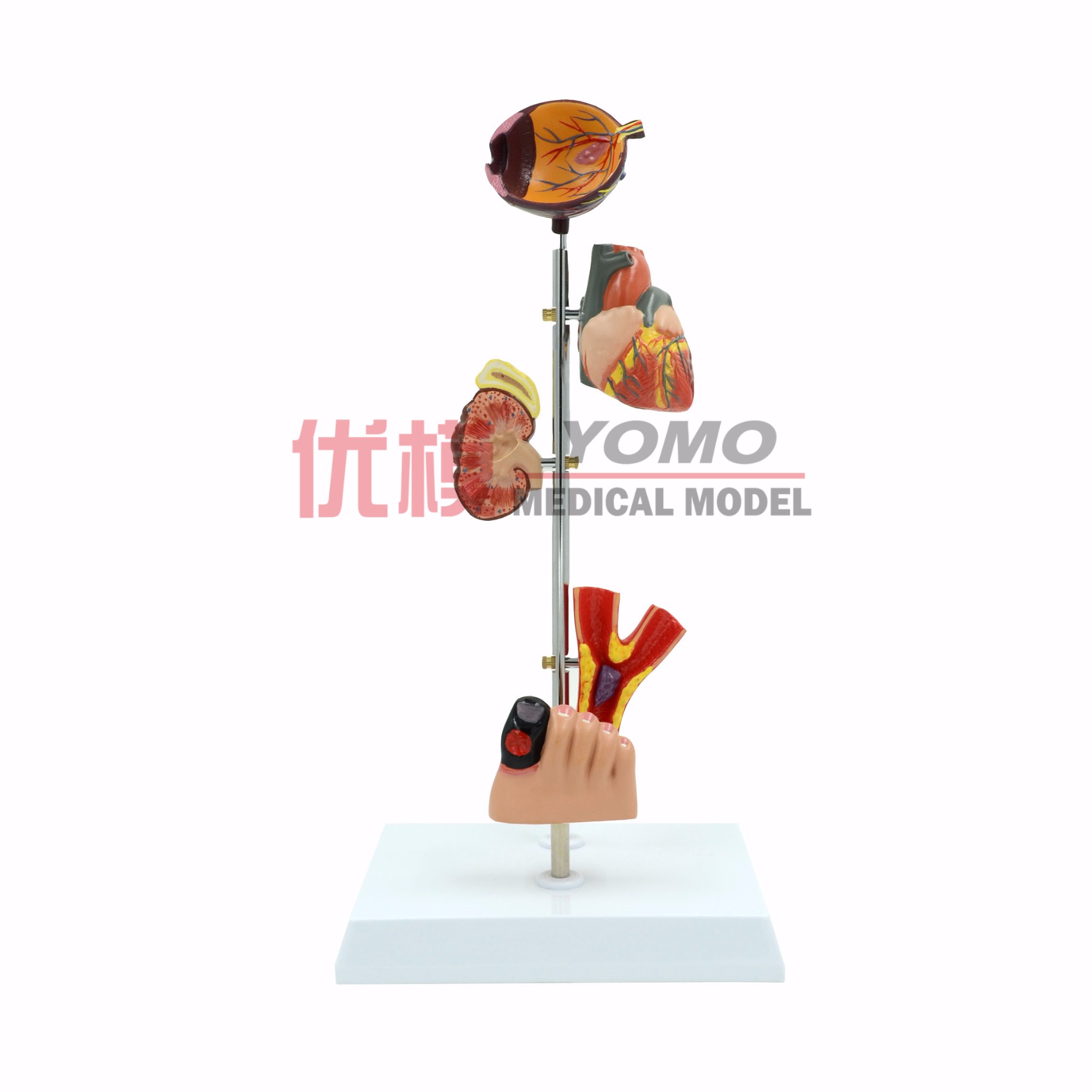 動(dòng)脈病變糖尿模型