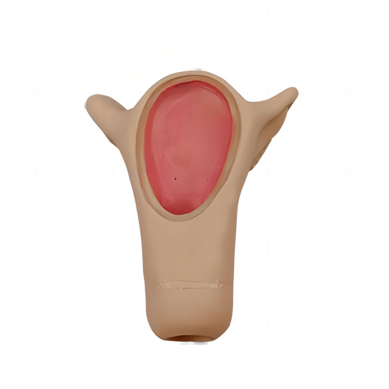 高級(jí)宮內(nèi)避孕訓(xùn)練模型