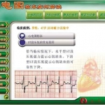 新版心電圖教學(xué)軟件