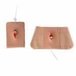 穿戴式二級開放性骨折模型