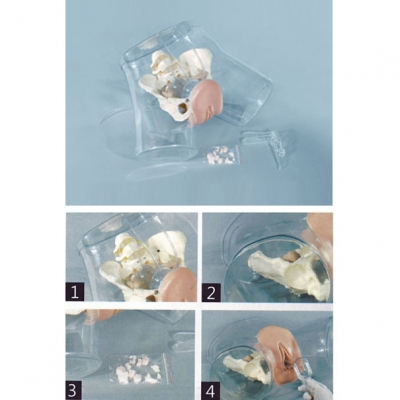 高級透明刮宮醫(yī)學訓練模型