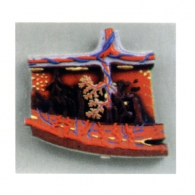 胎盤(pán)組織放大模型