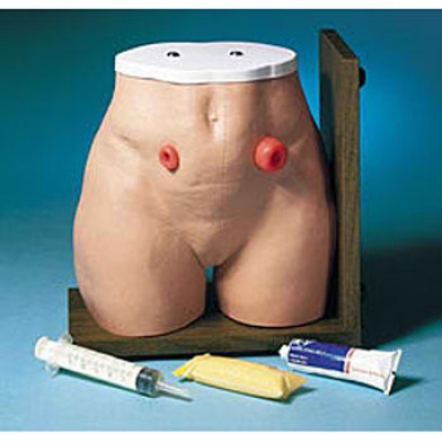 瘺管造口術(shù)護(hù)理模型