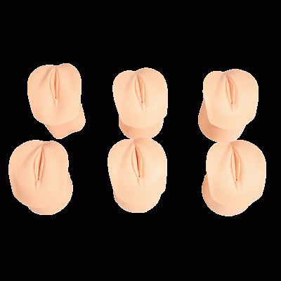 產前宮頸變化與產道關系模型