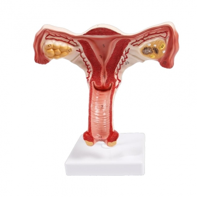 子宮放大模型