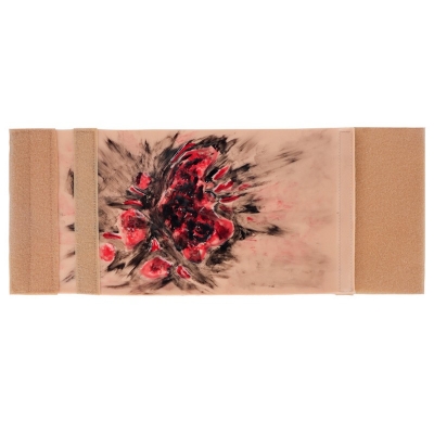 肢體燒傷訓練模塊